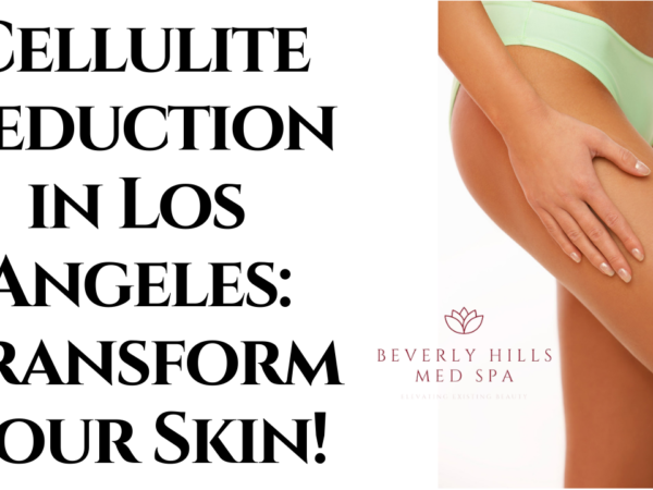 Cellulite Reduction in Los Angeles: Transform Your Skin!